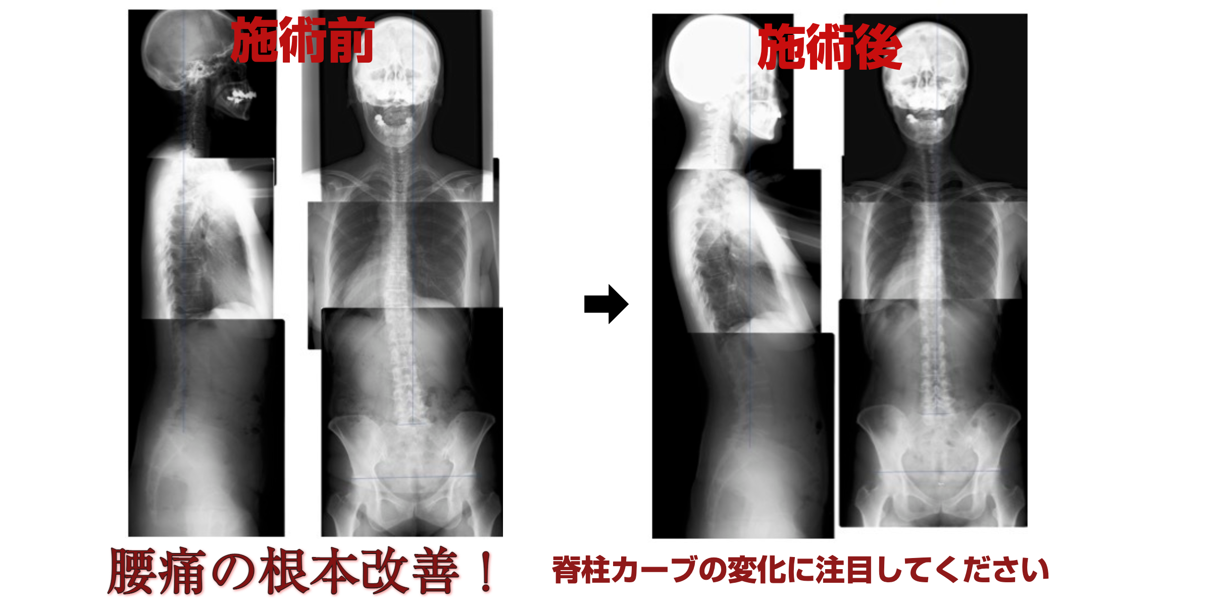 整体 整骨院 カイロプラクティック調整 ツールガン療法 スパイン アクチベータ補正 電動矯正機器 鍼灸オステ マッサージ機